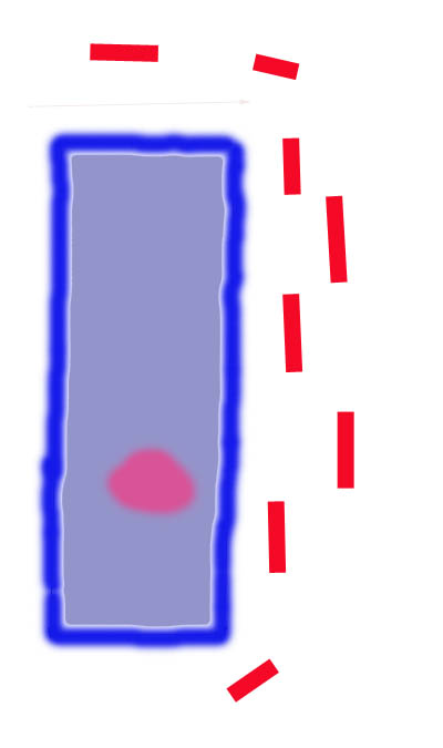  Cell surrounds with bacteria