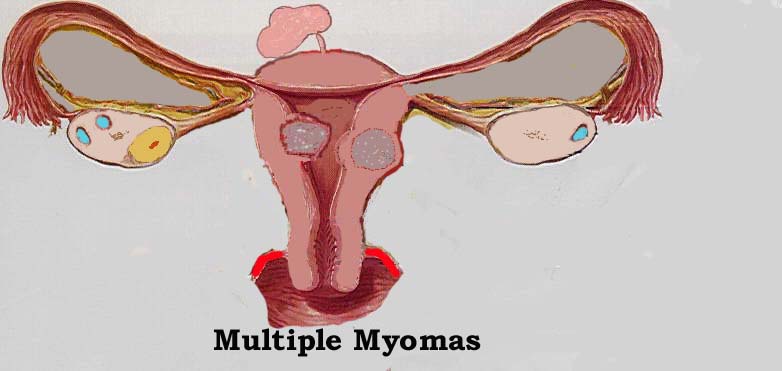   multiple in different positions