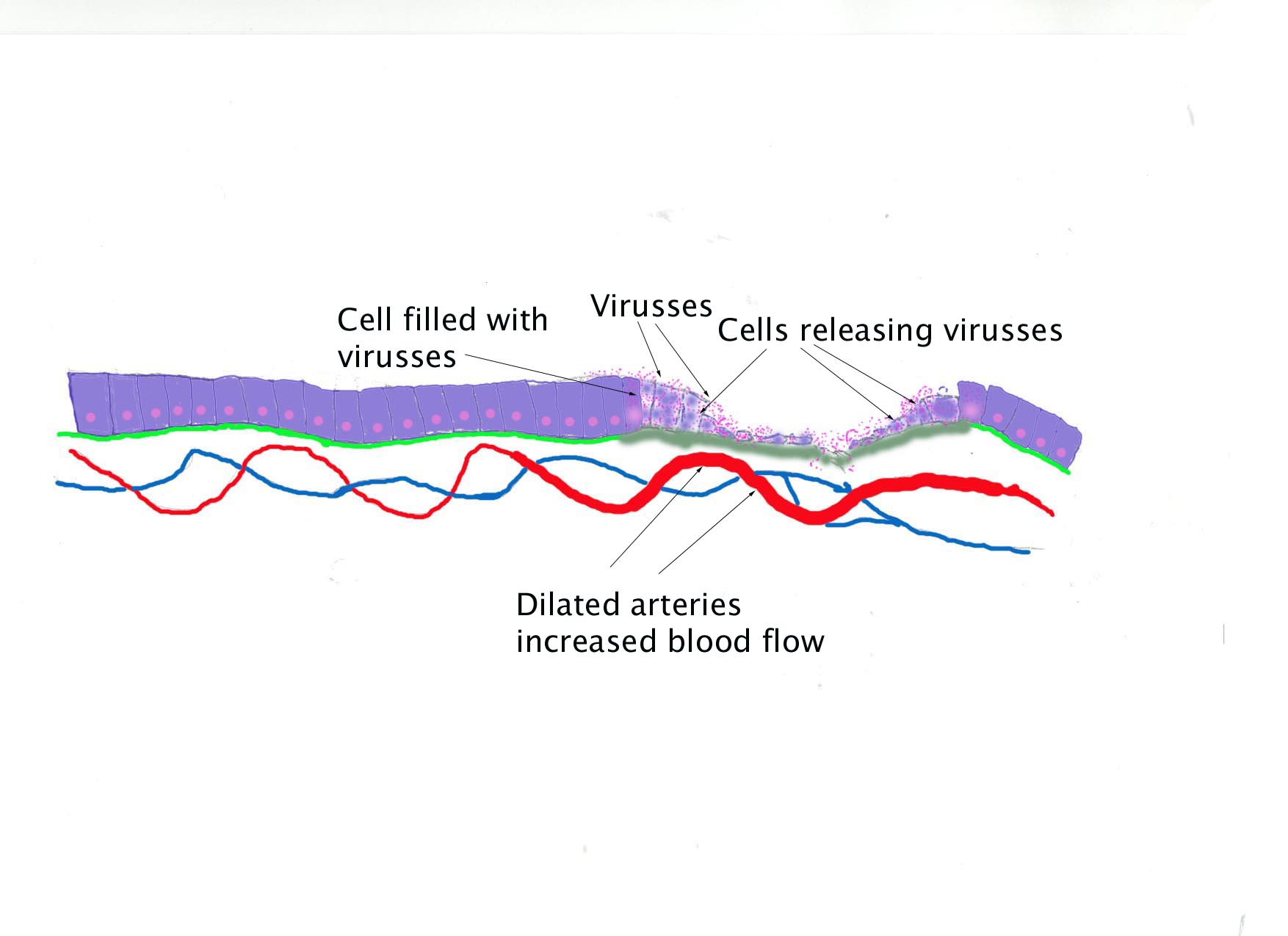 Tissue damged by a viral infection